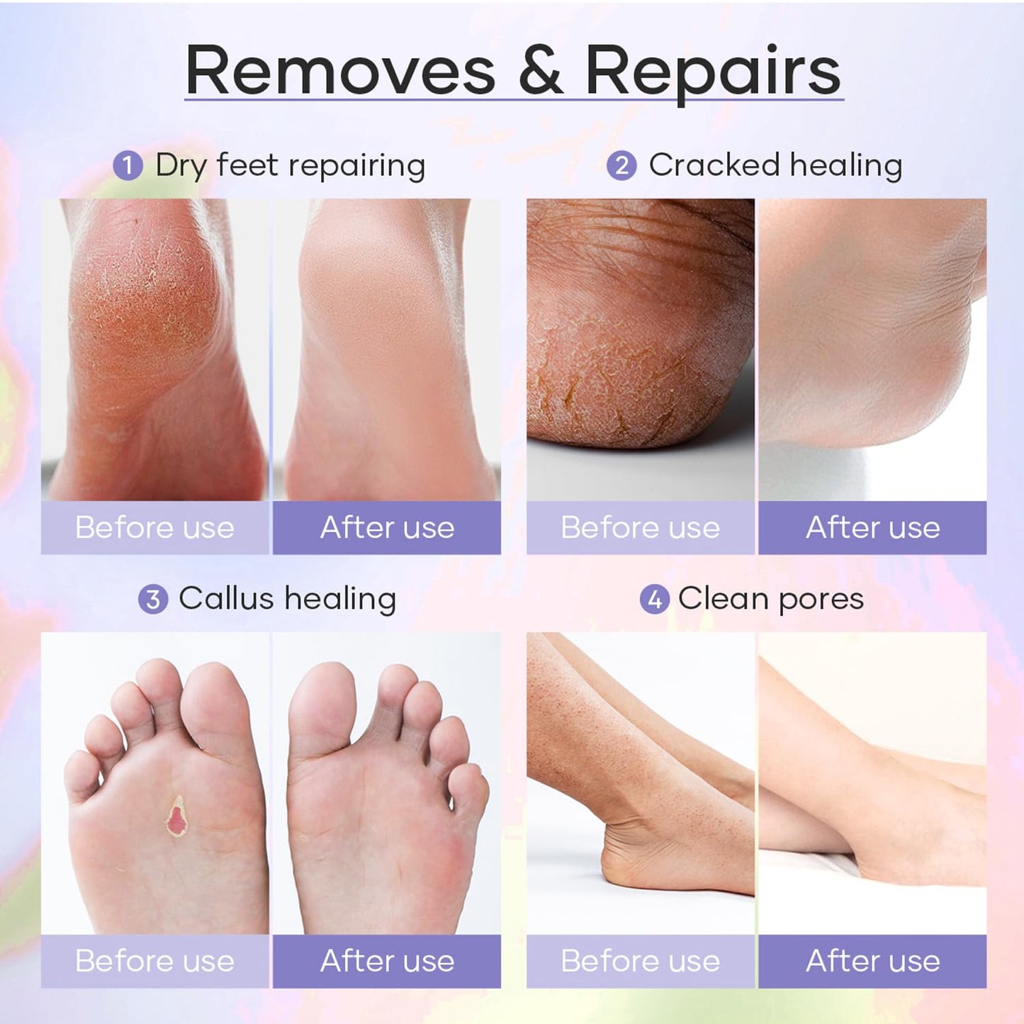 Epsom Salt Soak, Callus Remover Gel, Extreme Sugar Scrub, Collagen Mask & Shea Butter Lotion – Professional Spa Foot Care System 5 Step Luxury Pedicure Kit. Orange 03 Set-BrightBean Baby