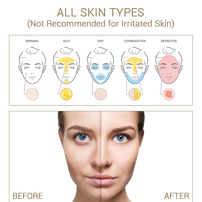 Niacinamide with Salicylic Acid Serum for Face, Hydrating Dark Spot Facial Serum & Plumb Skin, Daily Skincare Essential, 1 fl. oz, Made in Europe-BrightBean Baby