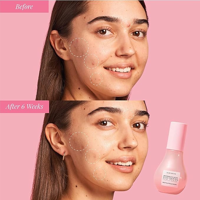 Glow Recipe Watermelon Niacinamide Dew Drops - Brightening, Plumping Hydrating Face Serum, Makeup Primer + Liquid Highlighter with Hyaluronic Acid - Dewy & Glowing Korean Skin Care (40ml)-BrightBean Baby