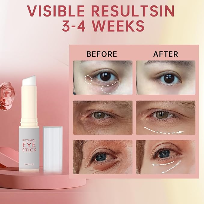 1Pcs Retinol Eye Stick, Retinol Under Eye Cream for Puffiness and Dark Circles, Hydrating Eye Cream Anti Aging for Enhanced Under Eye Nourishment.-BrightBean Baby