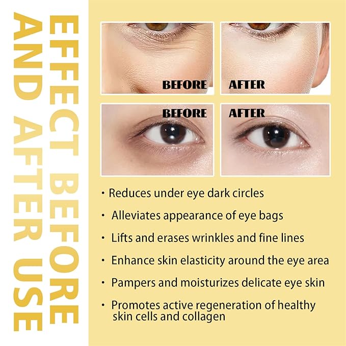 Time Eraser Rollerball Castor Oil and Frankincense, Time Eraser Rollerball, Castor Oil and Frankincense Eye Roller for Reducing Dark Circles and Bags Under Eyes-BrightBean Baby