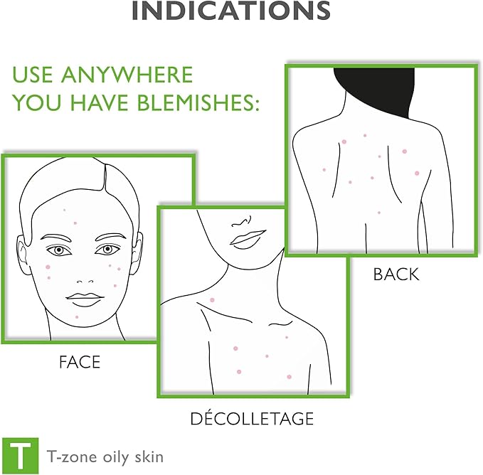 Face & Body Breakout Solution - 3% Mandelic Acid Helps Clarify Blemish & Acne Prone Skin, Face, Back & Chest Pimples Exfoliating & Clearing Treatment, SEBO-ALMOND-CLARIS, 6.42 fl oz-BrightBean Baby