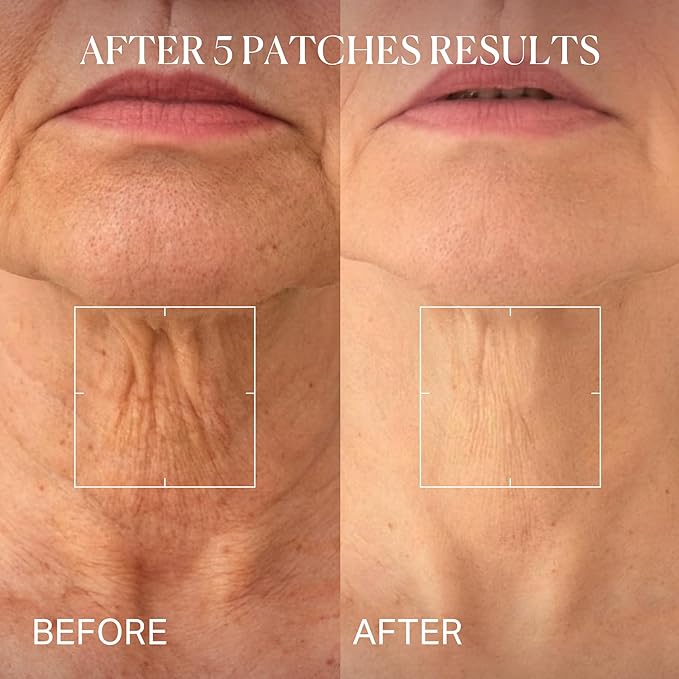 depology Tightening and Lifting Neck Wrinkle Patches with Cream, PDRN Deep Collagen Neck Mask, Firming Patch with PDRN、Collagen and Niacinamide Cream-BrightBean Baby
