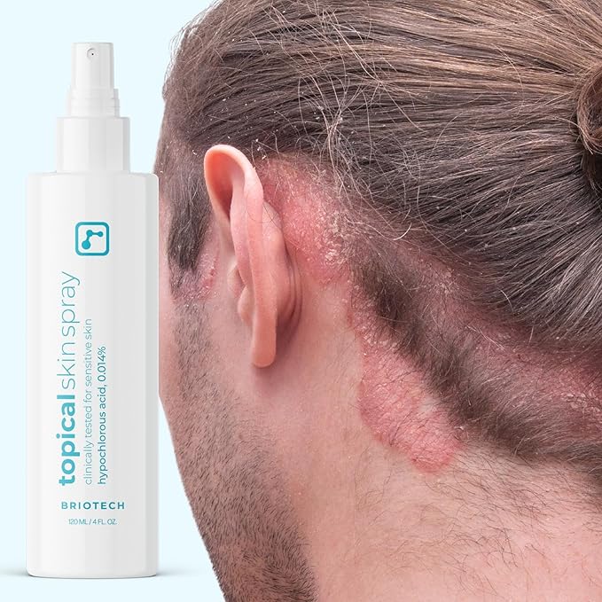 BRIOTECH Topical Skin Spray, Hypochlorous Acid Spray for Body & Face, Eyelid Cleanser, HOCl Facial Mist, Support Against Irritation, Calm Redness, Soothe Foot & Scalp, 32oz (2 Pack)