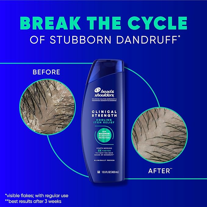 Head & Shoulders Clinical Strength Dandruff Shampoo, Selenium Sulfide Dandruff Defense, Intensive Itch Relief, Seborrheic Dermatitis Relief, Cooling Menthol, 13.5 Fl Oz Each, 2 Pack-BrightBean Baby