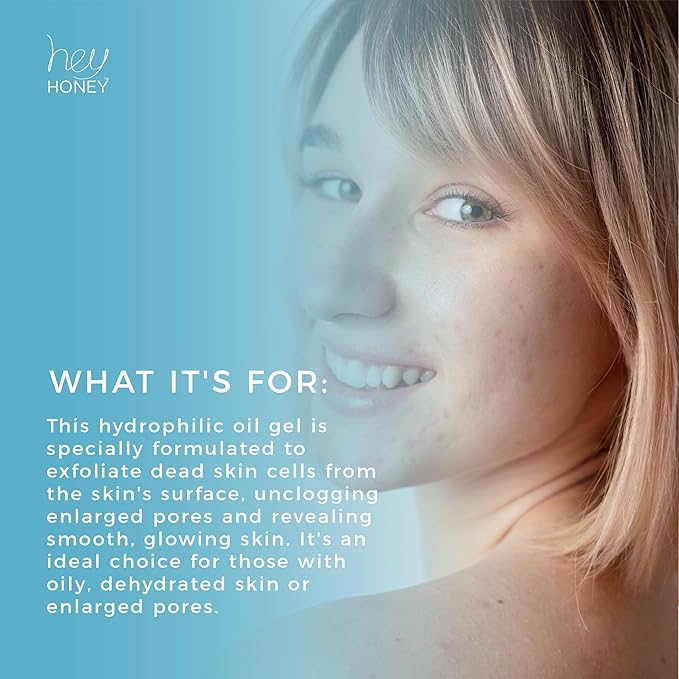 Hey Honey Skincare Be Clear - Acne Control Deep Pores Cleansing Gel | Propolis, Green Tea Oil, Camellia | Exfoliates, Unclogs Pores, Balances Oil Production | Fast Acting & Long Lasting | 2.7 Oz-BrightBean Baby