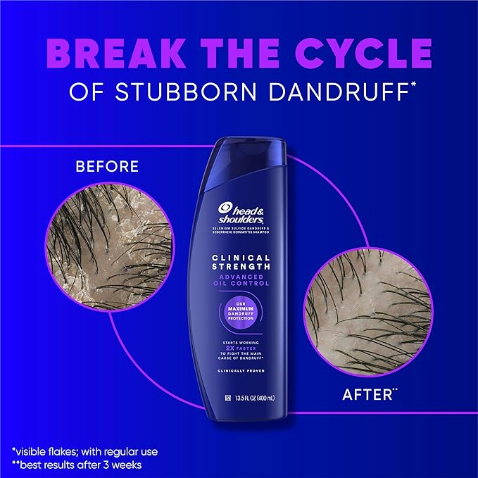 Head & Shoulders Clinical Dandruff Shampoo Twin Pack, Prescription Strength, Oil & Flake Control, Seborrheic Dermatitis Relief, Citrus, 13.5 Fl Oz Each (Set of 2)-BrightBean Baby
