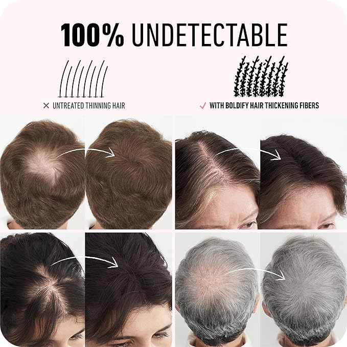 BOLDIFY Hair Fibers (28g) - Fill In Thinning and Fine Hair for an Instantly Fuller, Thicker Look - 14 Shades for Women & Men - Gray-BrightBean Baby