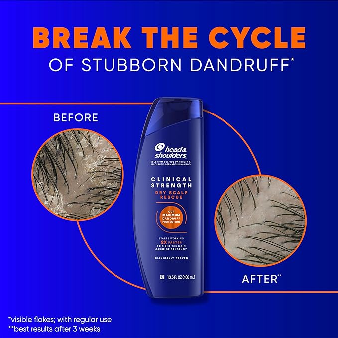 Head & Shoulders Clinical Dandruff Defense + Dry Scalp Rescue Shampoo 13.5 oz Twin Pack-BrightBean Baby