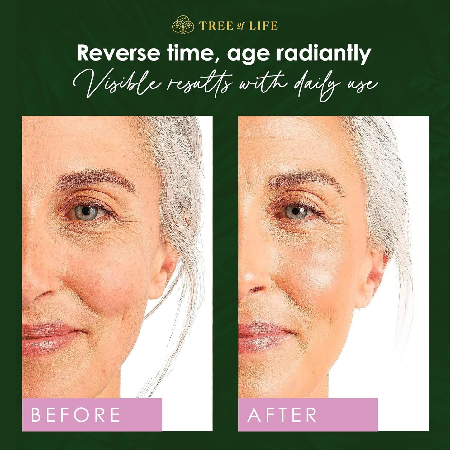 Tree of Life Beauty Retinol Serum, Skin Smoothing Face Oil for Dark and Age Spots and Fine Lines, Facial Serums for Dry and Sensitive Skin Care with Hyaluronic Acid for Soft Smooth Skin, 2 Fl Oz-BrightBean Baby