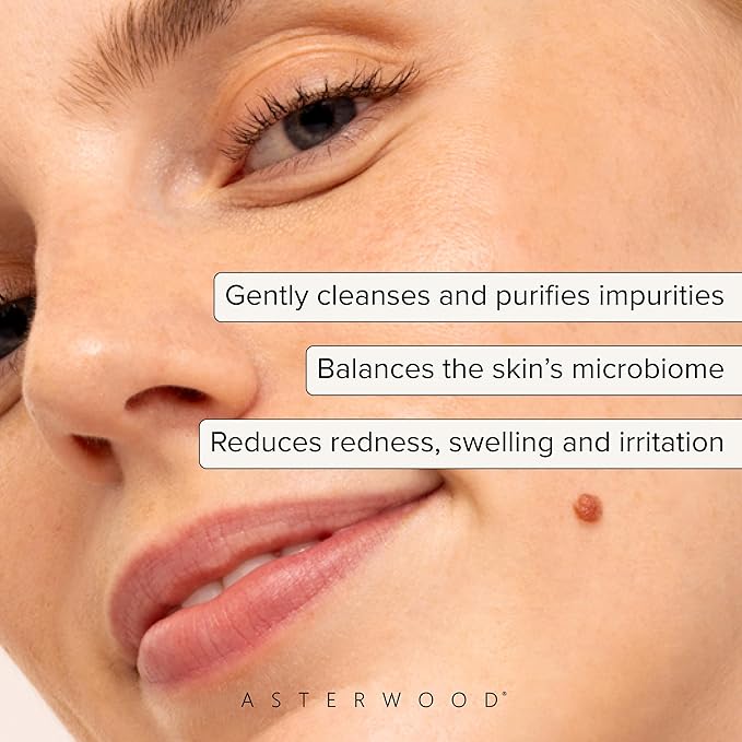 Asterwood Hypochlorous Acid Spray for Face - Targets Acne, Redness, Irritation - Multi-Purpose Skin Repair - Antibacterial, Antimicrobial - After Gym/Post-Workout Facial Mist - 4 Fl Oz-BrightBean Baby