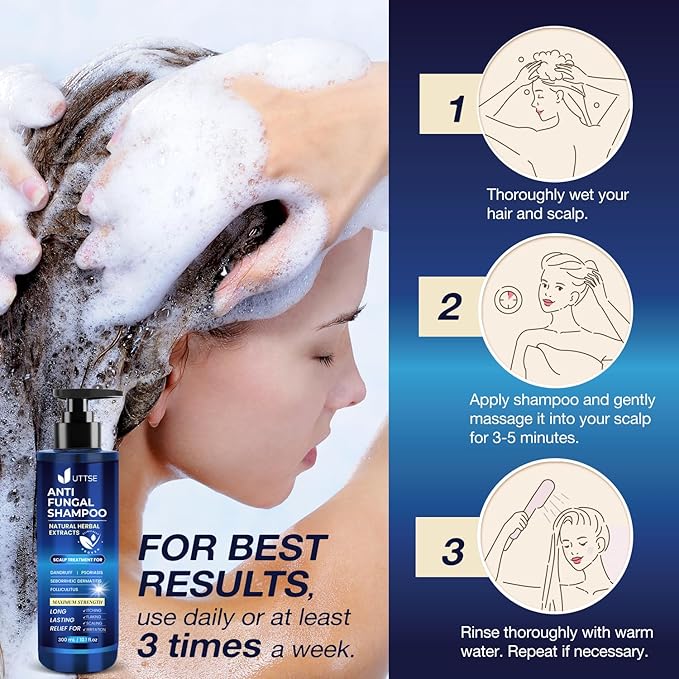 Anti-Fungal Shampoo for Scalp Psoriasis: Dandruff Shampoo for Folliculitis and Seborrheic Dermatitis - Relieves Itchy & Dry Scalp - 300 mL / 10.1 fl.oz-BrightBean Baby