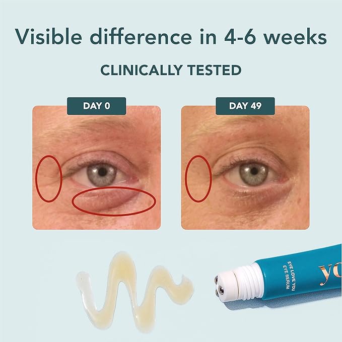 YOURS Eye Serum with Caffeine & Antioxidants | Hydrates and Brightens Under Eye Area | Restores Skin Firmness and Reduces Appearance of Fine Lines-BrightBean Baby