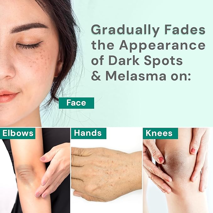 Ebanel Dark Spot Remover for Face & Body, Skin Brightening Cream with Synovea, Alpha Arbutin, Niacinamide, Kojic Acid, Dark Spot Corrector for Hyperpigmentation, Discoloration, Melasma, and Age Spots-BrightBean Baby