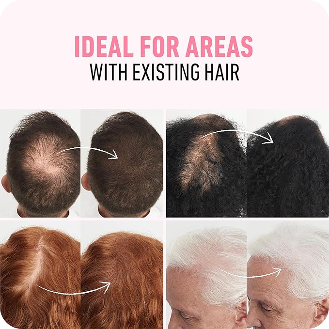 BOLDIFY Hair Fibers (28g) - Fill In Thinning and Fine Hair for an Instantly Fuller, Thicker Look - 14 Shades for Women & Men - Gray-BrightBean Baby