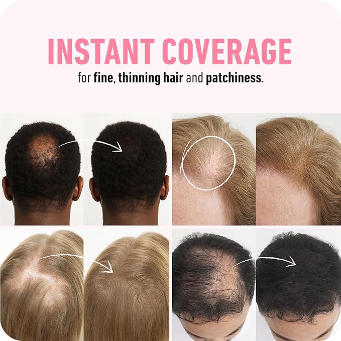 BOLDIFY Hair Fibers (28g) - Fill In Thinning and Fine Hair for an Instantly Fuller, Thicker Look - 14 Shades for Women & Men - Gray-BrightBean Baby