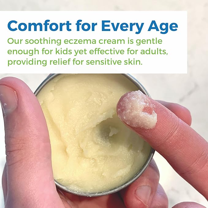 Waxhead Aftersun Body Butter for Sunburn Relief - Also great Tattoo Balm, Eczema Cream for Kids Adults, After Sun Lotion, Sunburn Treatment, Healing Salve-BrightBean Baby