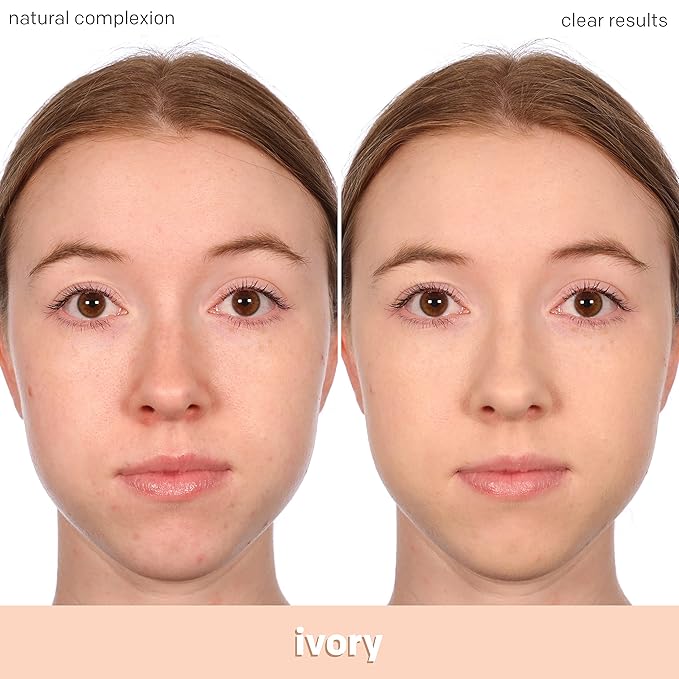 Almay Clear Complexion Acne Foundation Makeup with Salicylic Acid - Lightweight, Medium Coverage, Hypoallergenic, Fragrance-Free, for Sensitive Skin, 600 Sun Beige, 1 fl oz.-BrightBean Baby