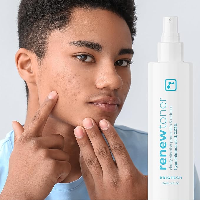 BRIOTECH Skin Renew Toner, Hypochlorous Acid Spray Topical Skin Spray for Face and Skin, Minimize Appearance of Blemishes, Soothing Mist for Redness & Bumps, 4 fl oz ea, 4 ct-BrightBean Baby