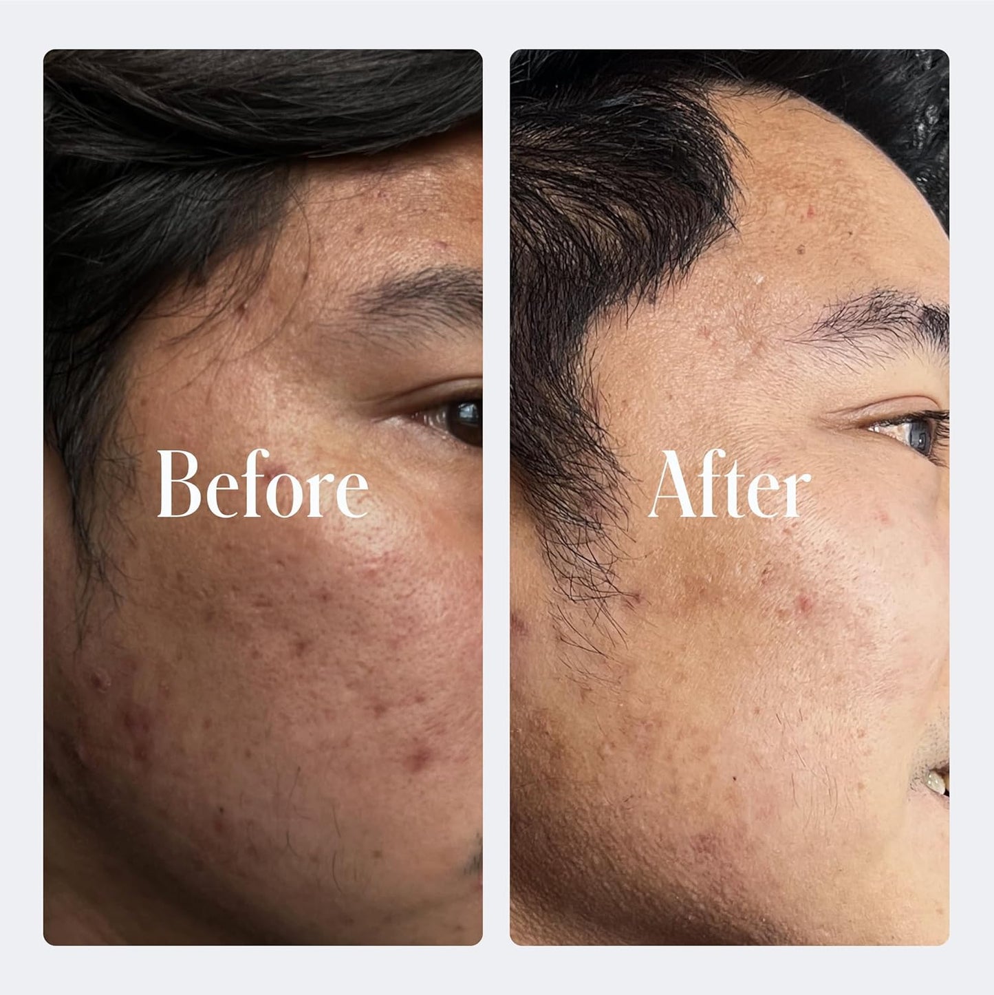 Geologie Retinol Anti-Aging Face Cream | Advanced .3% Retinol Formula for Effective Results | Reduce Fine Lines & Wrinkles | Protect & Repair Skin With Hyaluronic Acid & Niacinamide | For Men & Women-BrightBean Baby