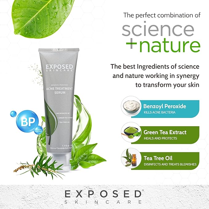 Exposed Skin Care Acne Treatment Serum Step 3 – Quickly Reduces Pimple Size and Redness - 12 Hour Spot Treatment - 3.5% Benzoyl Peroxide, Natural Green Tea & Tea Tree Oil-BrightBean Baby