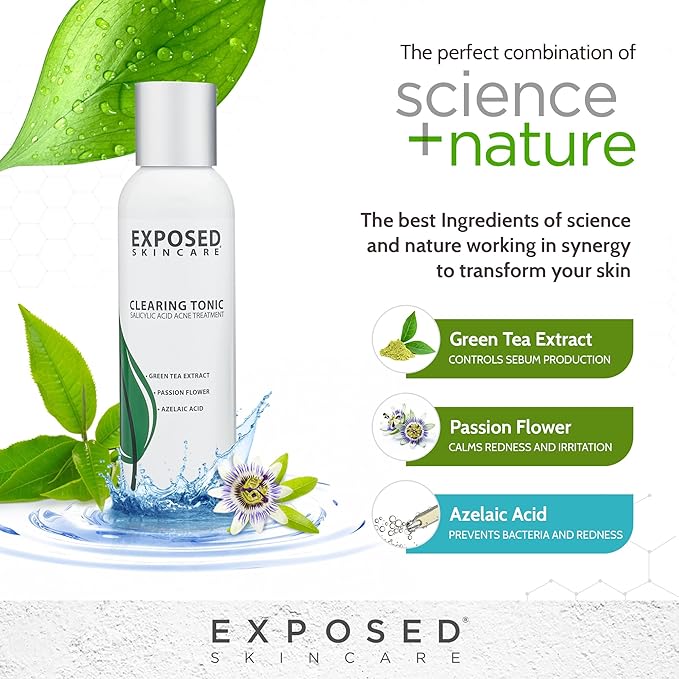Exposed Skin Care Clearing Tonic Facial Toner with 1% Salicylic Acid and Witch Hazel for Acne Treatment – Pore Minimizing Toner to Prevent Breakouts, Reduce Redness and Balance Skin – Step 2 (4 fl oz)-BrightBean Baby