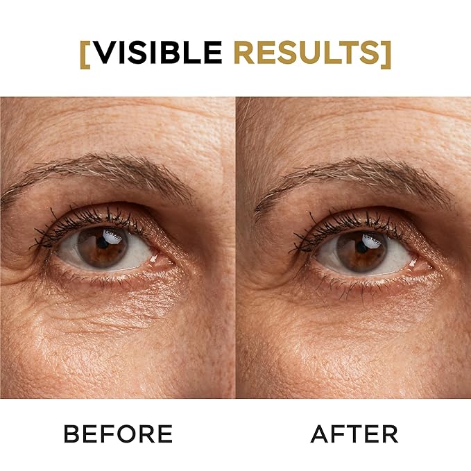 Moisturizing Eye Cream w/Aloe Vera, Collagen, Hyaluronic Acid, Cotton Stem Cells for Dark Circles, Puffiness & Bags - Under Eye Hydration Cream for Women & Men (1 Fl Oz)-BrightBean Baby