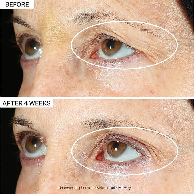 StriVectin Tighten & Lift Peptight 360 Degree Eye Serum with Tightening & Brightening Peptides for Wrinkles, Under Eye Bags and Puffiness, 1 fl. Oz-BrightBean Baby