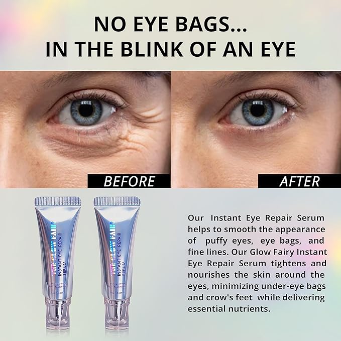 Eye Repair Serum (10g) - Under Eye Cream for Dark Circles to Reduces Eye Bags, Puffiness and Wrinkles - Eye Cream (2 pack)-BrightBean Baby