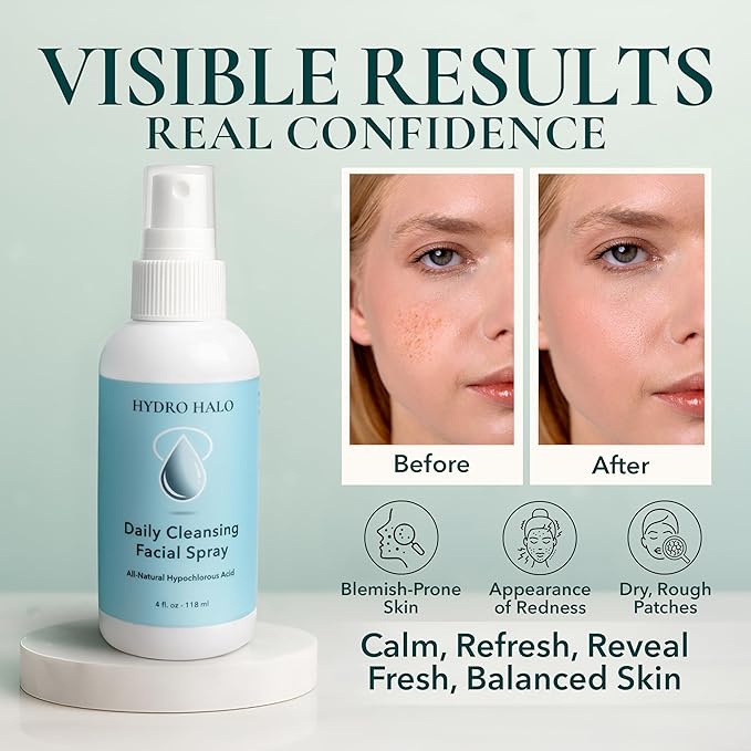 Hypochlorous Acid Spray for Face 4oz – Pure Hypochlorous Acid Spray Cleaner, Daily Cleansing Facial, pH Balanced, Plant Based, No Alcohol, USA Made-BrightBean Baby