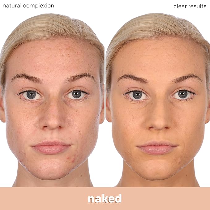 Almay Clear Complexion Acne Foundation Makeup with Salicylic Acid - Lightweight, Medium Coverage, Hypoallergenic, Fragrance-Free, for Sensitive Skin, 400 Neutral, 1 fl oz.-BrightBean Baby