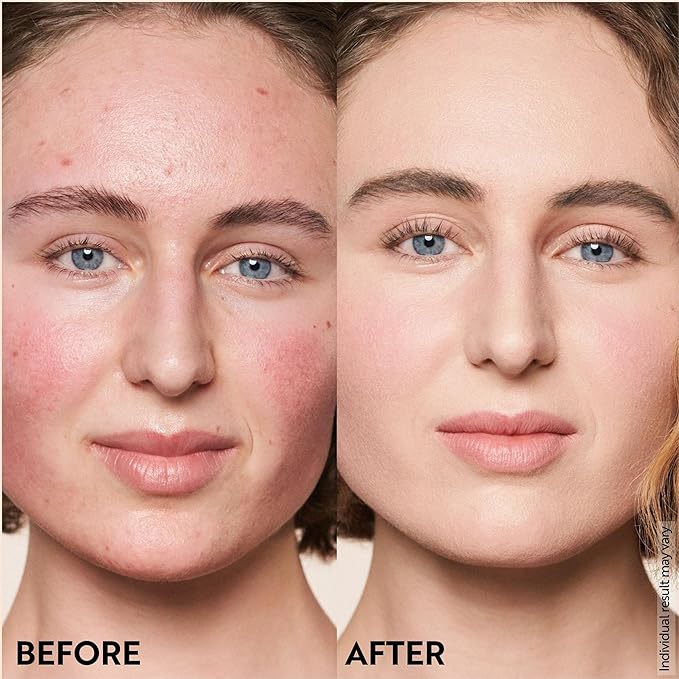 M. Asam Magic Finish Porcelain Teint Make-Up Mousse (1.01 Fl Oz) – 4in1 Primer, Foundation, Concealer & Powder With Buildable Coverage, Adapts To Fair Skin Tones, Leaves Skin Looking Flawless-BrightBean Baby