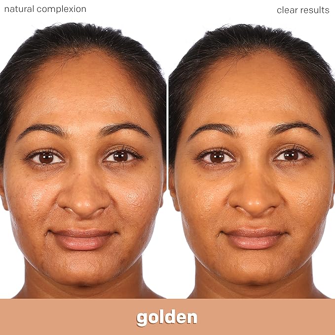 Almay Clear Complexion Acne Foundation Makeup with Salicylic Acid - Lightweight, Medium Coverage, Hypoallergenic, Fragrance-Free, for Sensitive Skin, 730 Golden Caramel, 1 fl oz.-BrightBean Baby