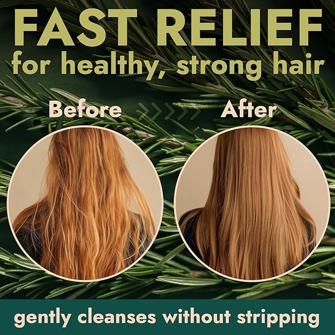 Rosemary Shampoo and Conditioner Set Infused with Tea Tree & Rosemary Oils for Scalp Relief and Hair Growth | Sulfate Free, Soothes Dry Scalp, Boosts Shine + Free Scalp Brush | 16.9 fl oz-BrightBean Baby