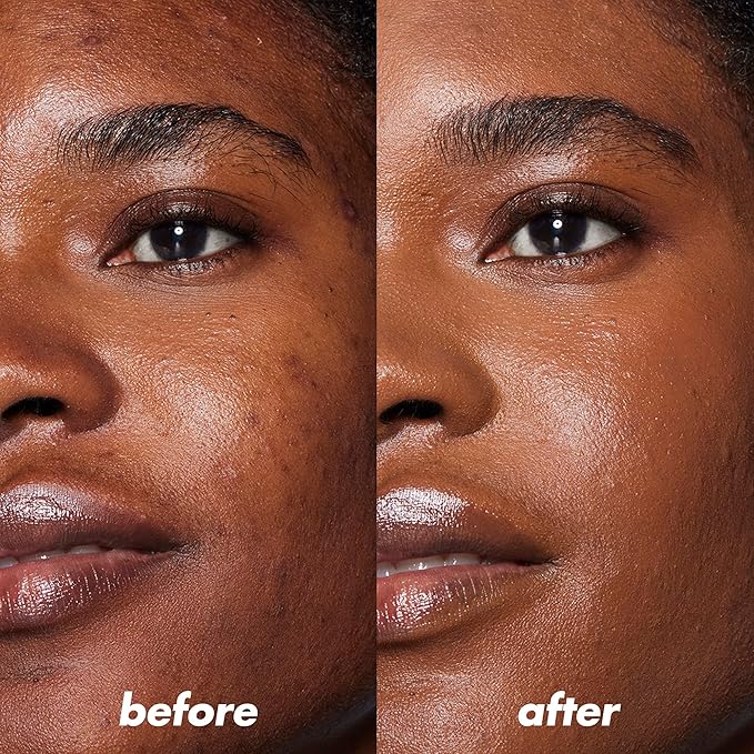 e.l.f. Camo Color Corrector, Hydrating & Long-Lasting Color Corrector For Camouflaging Discoloration, Dullness & Redness, Vegan & Cruelty-Free, Orange-BrightBean Baby