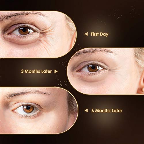 Anti Aging Eye Cream, Retinol Eye Cream Contains Niacinamide and Hyaluronic Acid, Reduces Wrinkles, Puffiness, Crows Feet and Dark Circles, 1 Oz-BrightBean Baby