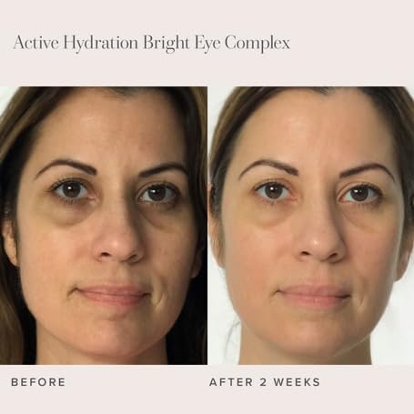 RODAN + FIELDS Active Hydration Bright Eye Complex | 15ml | Moisturizing Under Eye Cream for Dry Skin | Brightening Eye Treatment | Skincare-BrightBean Baby