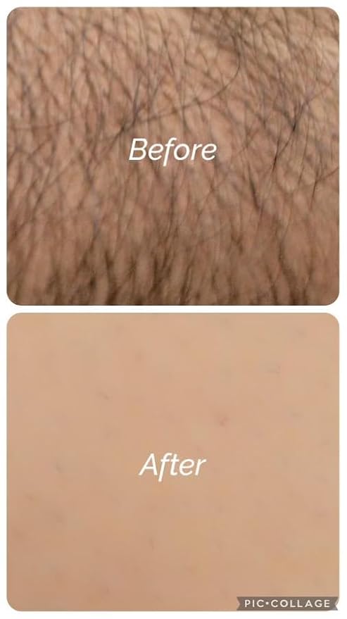 ARABESKS Dermaplaning Tool, 3ct | Dermaplane, Face Razors for Women, Eyebrow Razor, Facial Razor, Dermaplaning Razor, Womens Face Razor Peach Fuzz Remover, Eyebrow Trimmer-BrightBean Baby