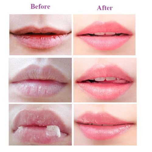 2PCS Lip Balm Honey Pot,Honey & Strawberry Lip Balm, Propolis Moisturizing Honey Lip Mask Lip Balm, Hydrating & Prevention Dry and Cracked Lip Scrubs Exfoliator-BrightBean Baby