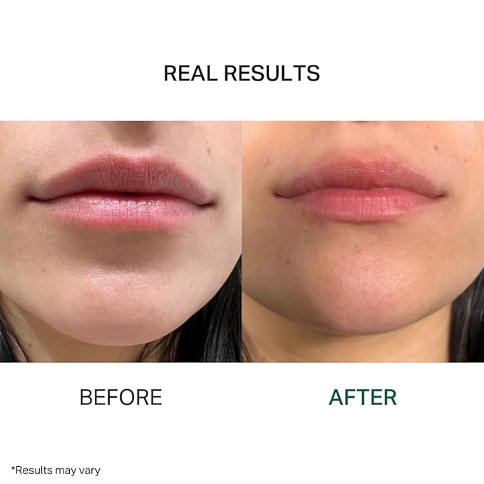 Y’OUR Intensive Lip Balm | Overnight Lip Mask: Lightweight & Comforting with Natural Shea Butter & Rosehip Oil; Extreme Moisturizer for Dry Lips. Paraben & Silicon-Free. Made in USA. 15ml (0.5 oz.)-BrightBean Baby