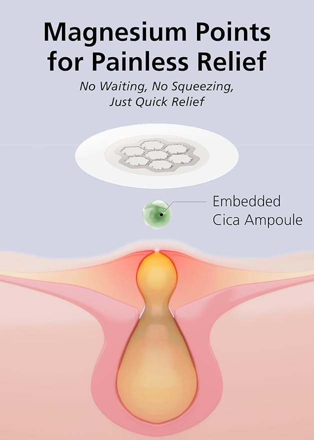 EasyDerm Quick Calming Magnesium Patches – 40 Patches (4 Pack), Hydrocolloid Acne Spot Treatment with Tea Tree & Cica, Bulk Value Pack for Acne-Prone Skin, Ideal for Home Skincare-BrightBean Baby