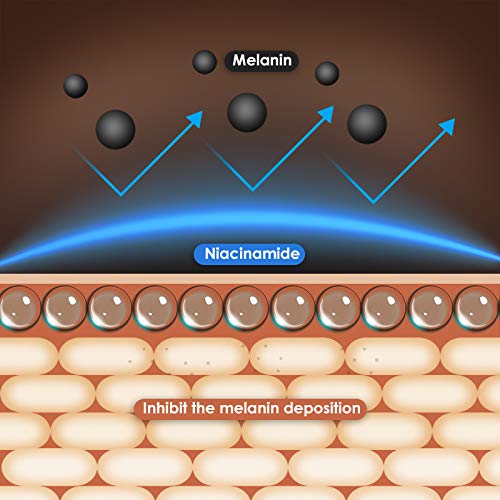 Anti Aging Eye Cream, Retinol Eye Cream Contains Niacinamide and Hyaluronic Acid, Reduces Wrinkles, Puffiness, Crows Feet and Dark Circles, 1 Oz-BrightBean Baby