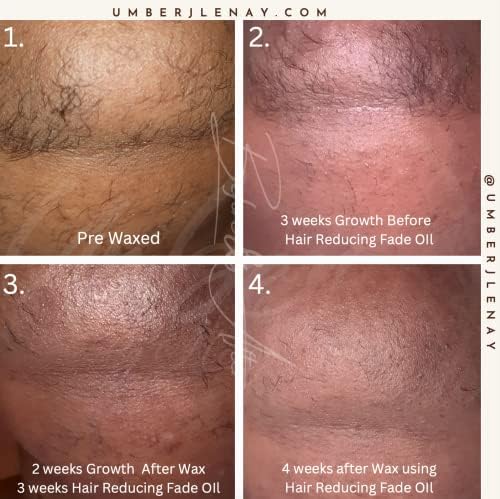 Hair Reducing Fade Oil - Sentive Strength (For sentive skin) Hair Growth Minimizer, Slow Down Facial Hair Growth for Women & Men, Hair Inhibitor Serum, Moisturizing & Soothing, 15ml-BrightBean Baby