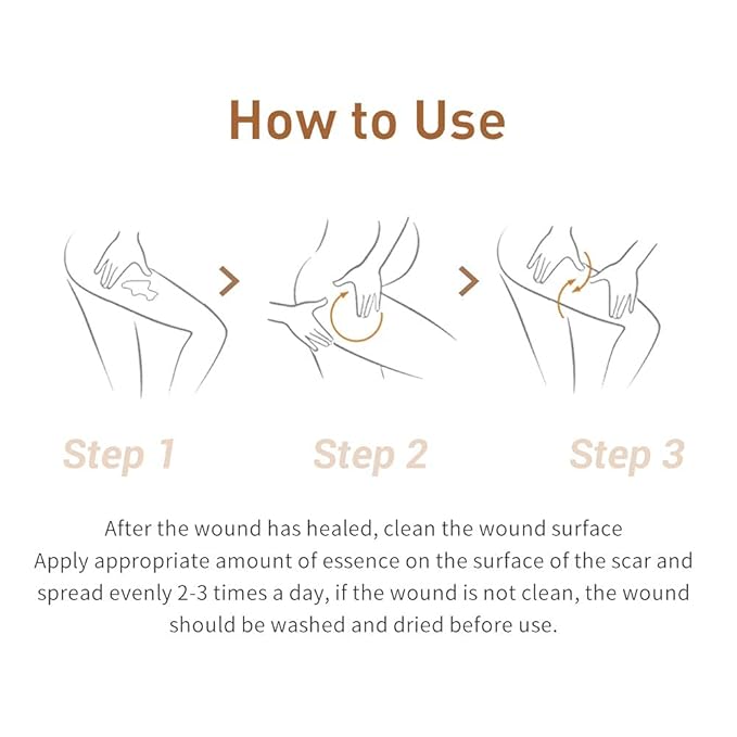 Acne Scar Removal Cream Stretch Marks Face Skin Cream Shrink Pores Gel-Fade Scar Marks Acne Skin Care (Packaging Upgrade) VeniCare-BrightBean Baby