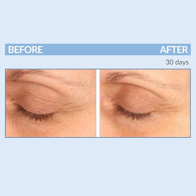 Serious Skincare - Eyetality PM Total Eye Care - Evening Night Eye Cream with Lash Boosting Peptides for Thicker, Longer Lashes - 0.5 oz.-BrightBean Baby