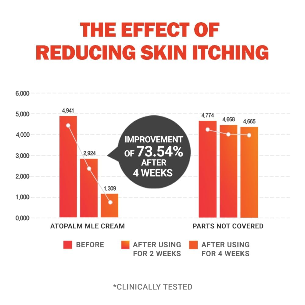 ATOPALM | MLE Eczema Cream | Premium Baby Lotion Newborn | Baby Face and Body Moisturizer for Skin Barrier | Moisturizing Facial Cream for Itchiness & Redness | Korean Skincare | 2.2 fl oz (65ml)-BrightBean Baby