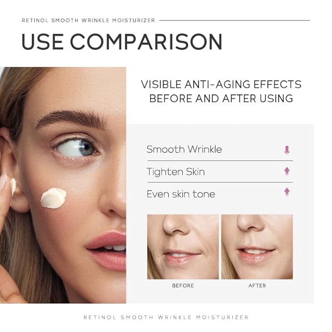 Anti Aging Skin Care Set, 1% Retinol Dark Spot Remover for Face with Face Serum & Moisturizer, Travel Size Skincare Set for Women, Reduce Wrinkles, Firm & Hydrate for All Skin Types-BrightBean Baby