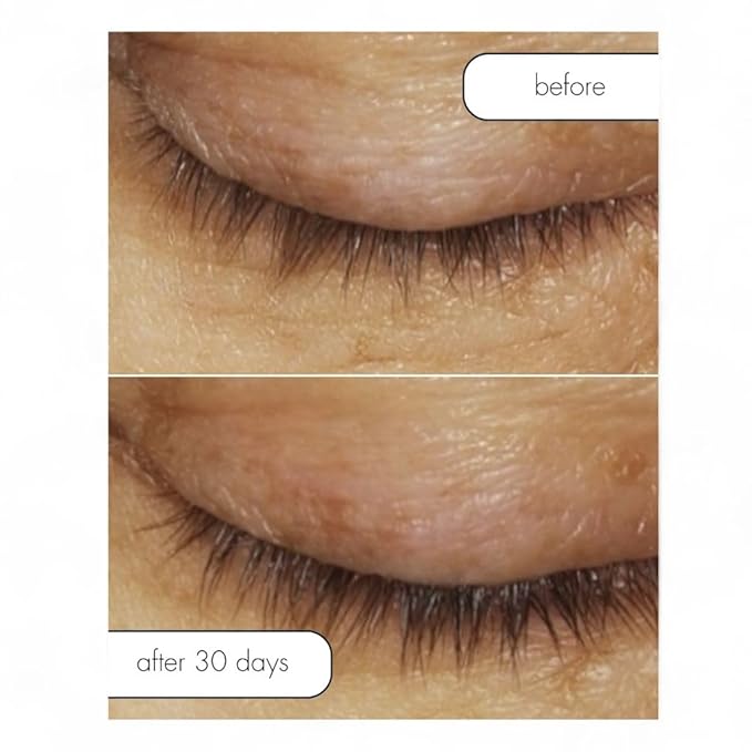 Serious Skincare Lash Bath & Conditioner - Double Action Eye Makeup Remover - Oil Free - Enhancing Peptides Promotes Eyelash Growth - Clover Flower - Effortlessly Removes Waterproof Mascara - 4 oz.-BrightBean Baby