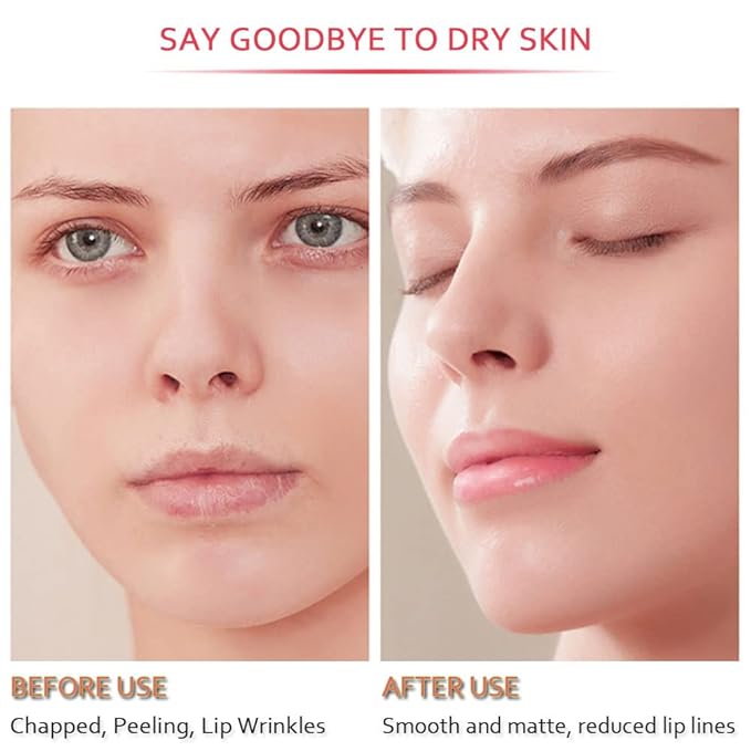 20Pcs Moisturizing Restores Moisture Lip Mask for Dry Lips and Lip Lines Overnight Lip Care, Gel Treatment Plumping Lips Mask (Red)-BrightBean Baby