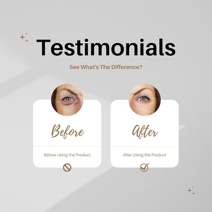 Eye Cream Peptide Snail Mucin Filtrates! NIACINAMIDE- Moisturizer, Brightening, Reduce Dark Circles & Wrinkles, Fine Lines, Sign of Aging. Made in Korea Skincare!-BrightBean Baby